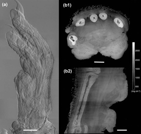 硬X射线相位衬度CT成像研究获得重大进展